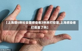 【上海增5例社会面感染者2例未打疫苗,上海感染者打疫苗了吗】