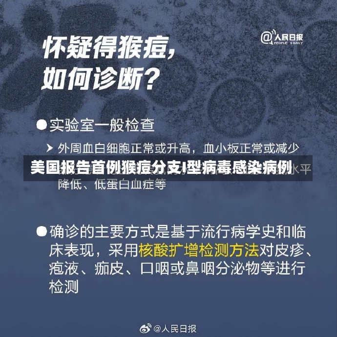 美国报告首例猴痘分支I型病毒感染病例-第1张图片-建明新闻