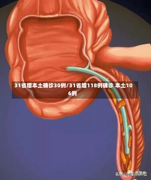 31省增本土确诊30例/31省增118例确诊 本土106例-第2张图片-建明新闻