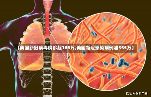 【美国新冠病毒确诊超166万,美国新冠感染病例超355万】-第2张图片-建明新闻