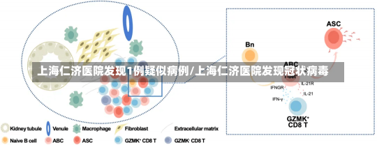 上海仁济医院发现1例疑似病例/上海仁济医院发现冠状病毒-第2张图片-建明新闻